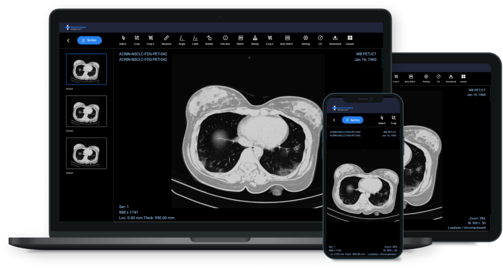 mobile DICOM viewer
